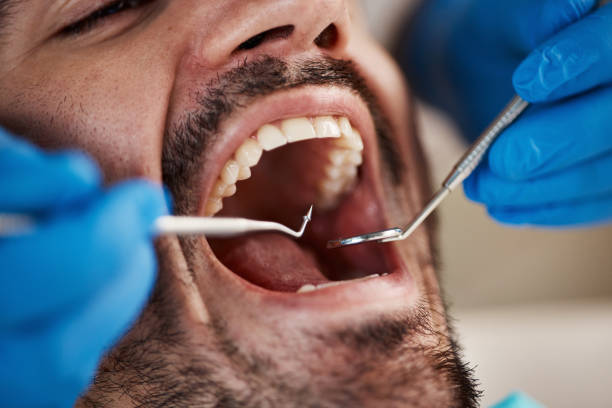 Best Emergency Tooth Extraction in Penhook, VA