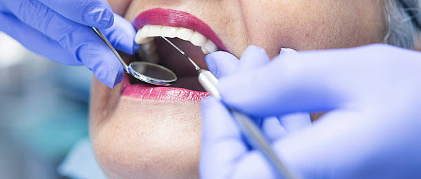 Best Emergency Dental Care for Broken or Chipped Teeth in Penhook, VA